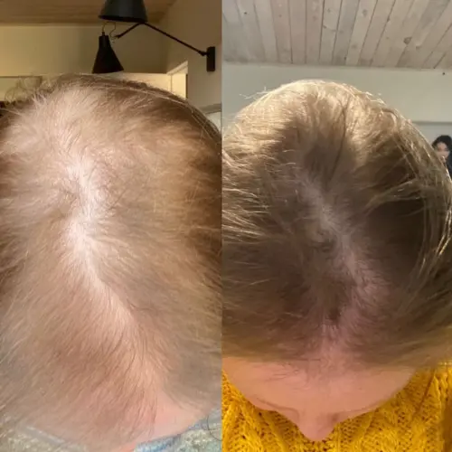 Collagen Tripeptide & Vitamine C - Image 5