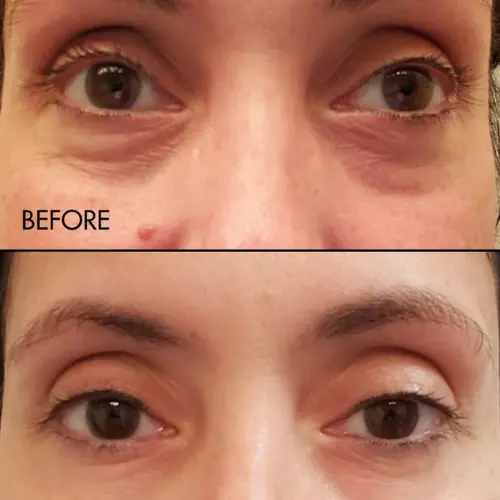 Fermentation Peptin Eye Care Cream - Image 3